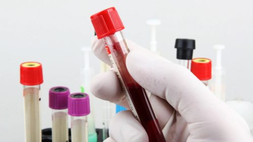 How Do Priority Post Boxes Support NHS Test and Trace