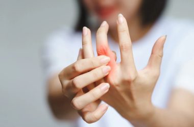 lifestyle and inflammatory arthritis