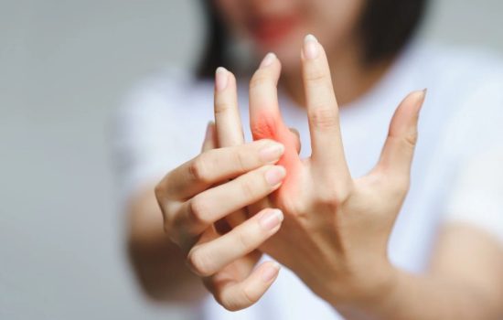 lifestyle and inflammatory arthritis