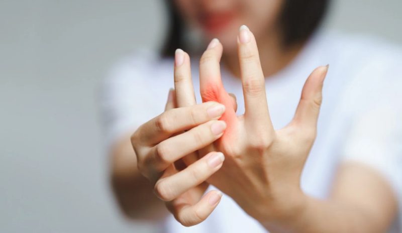 lifestyle and inflammatory arthritis