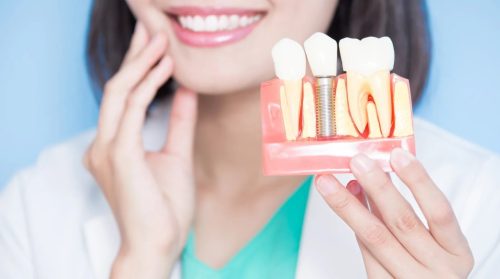 Ideal for Severe Bone Loss