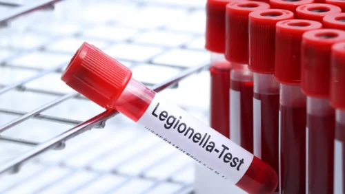 How Often Should a Legionella Risk Assessment Be Reviewed