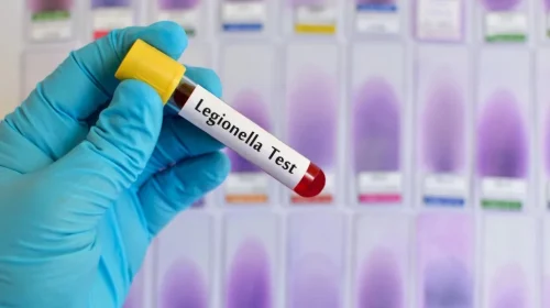 What Is a Legionella Risk Assessment